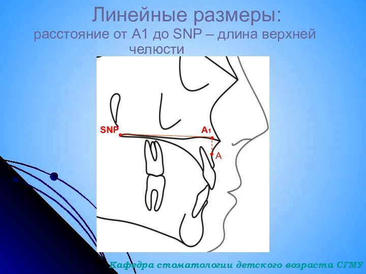 Линейные размеры: расстояние от А1 до SNP – длина верхней