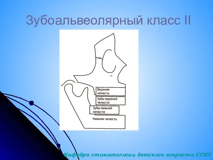 Зубоальвеолярный класс II Кафедра стоматологии детского возраста СГМУ