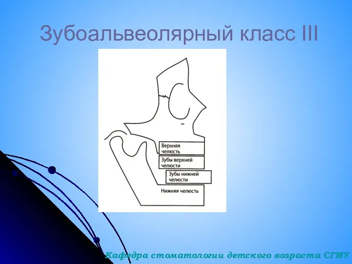 Зубоальвеолярный класс III Кафедра стоматологии детского возраста СГМУ