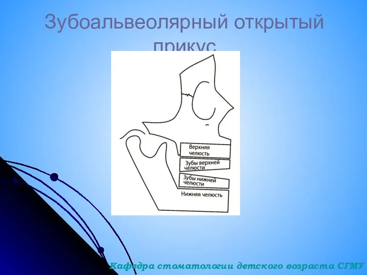 Зубоальвеолярный открытый прикус Кафедра стоматологии детского возраста СГМУ