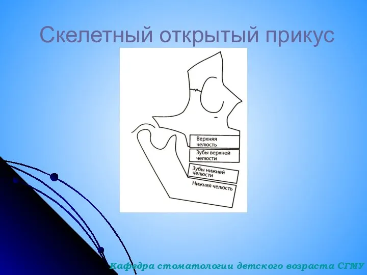 Скелетный открытый прикус Кафедра стоматологии детского возраста СГМУ