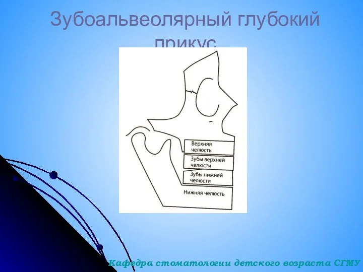 Зубоальвеолярный глубокий прикус Кафедра стоматологии детского возраста СГМУ