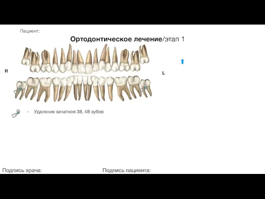 Пациент: Ортодонтическое лечение/этап 1 Подпись врача: Подпись пациента: R L - Удаление зачатков 38, 48 зубов