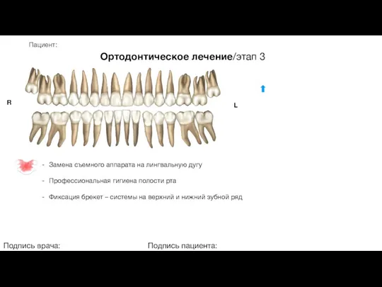 Пациент: Ортодонтическое лечение/этап 3 Подпись врача: Подпись пациента: R L Замена съемного аппарата