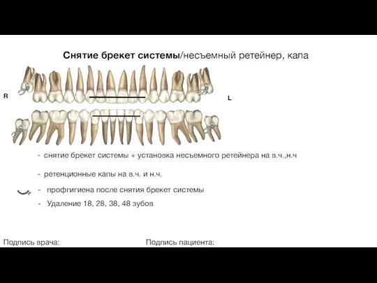 Снятие брекет системы/несъемный ретейнер, капа Подпись врача: Подпись пациента: R