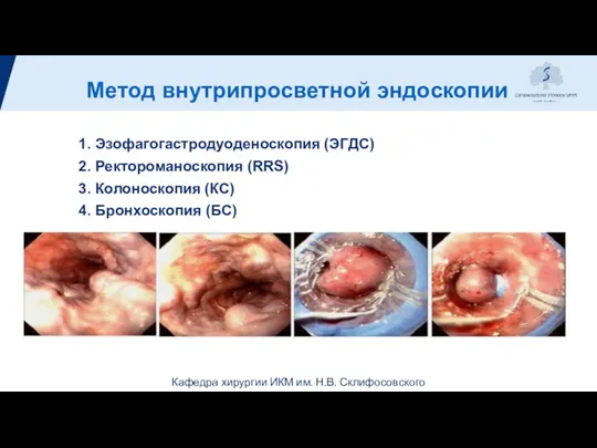 Метод внутрипросветной эндоскопии 1. Эзофагогастродуоденоскопия (ЭГДС) 2. Ректороманоскопия (RRS) 3. Колоноскопия (КС) 4. Бронхоскопия (БС)