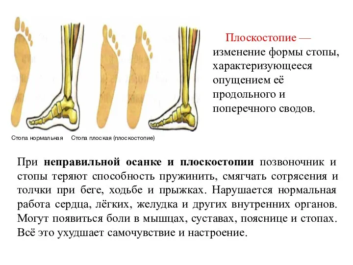 При неправильной осанке и плоскостопии позвоночник и стопы теряют способность