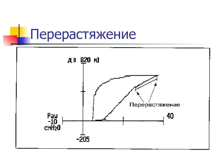 Перерастяжение