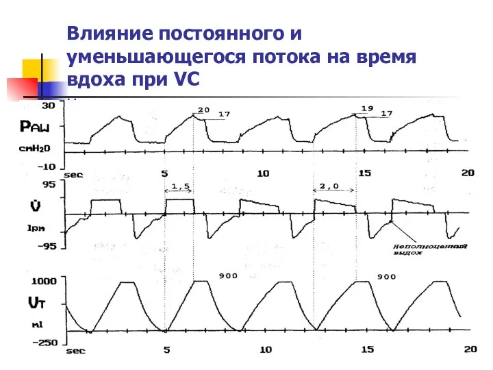 Влияние постоянного и уменьшающегося потока на время вдоха при VC н