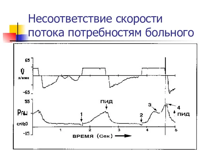 Несоответствие скорости потока потребностям больного