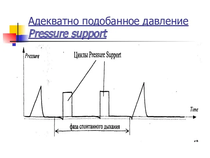 Адекватно подобанное давление Pressure support