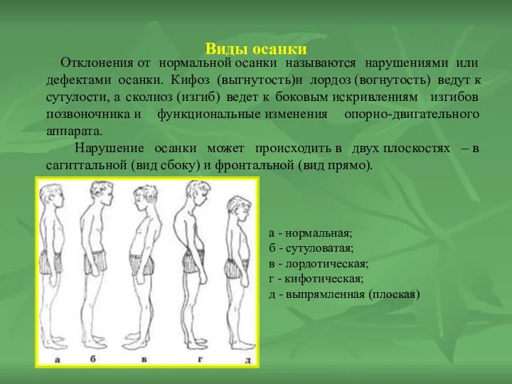 Виды осанки Отклонения от нормальной осанки называются нарушениями или дефектами