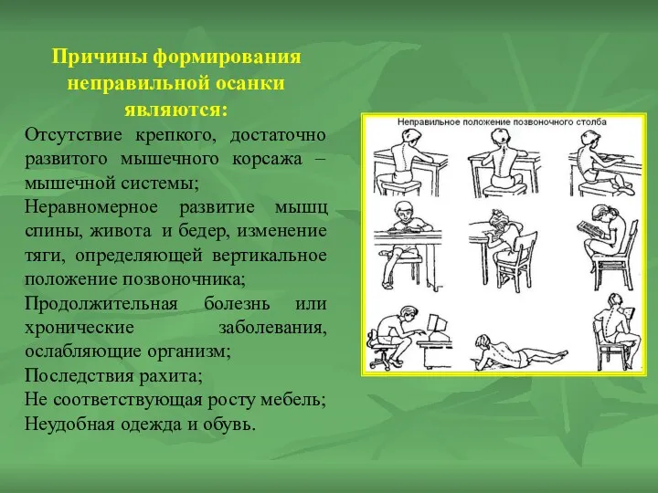 Причины формирования неправильной осанки являются: Отсутствие крепкого, достаточно развитого мышечного