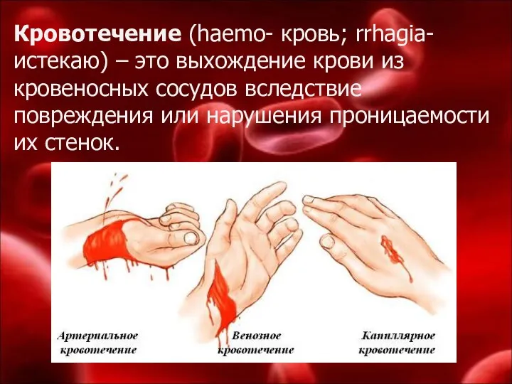 Кровотечение (haemo- кровь; rrhagia-истекаю) – это выхождение крови из кровеносных