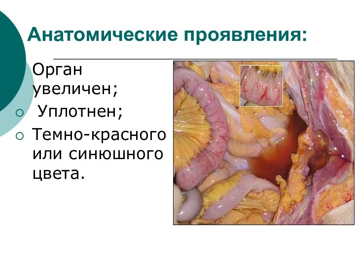 Анатомические проявления: Орган увеличен; Уплотнен; Темно-красного или синюшного цвета.