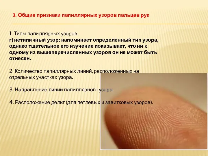 3. Общие признаки папиллярных узоров пальцев рук 1. Типы папиллярных