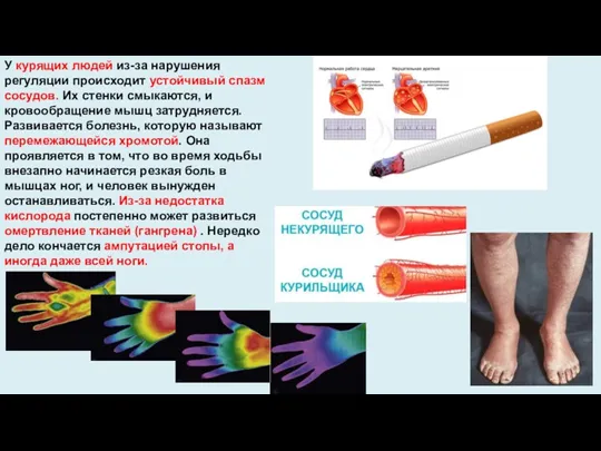 У курящих людей из-за нарушения регуляции происходит устойчивый спазм сосудов.
