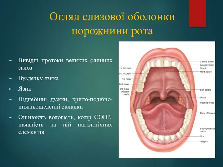 Огляд слизової оболонки порожнини рота Вивідні протоки великих слинних залоз