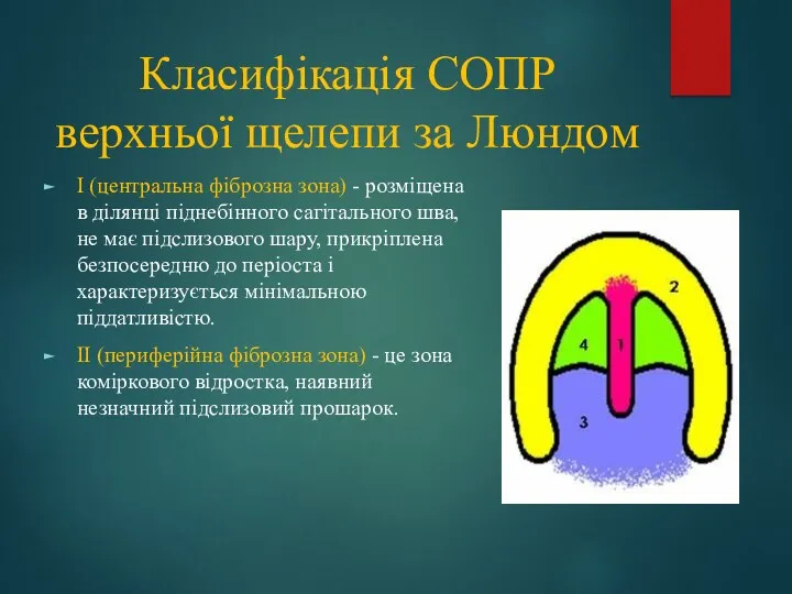 Класифікація СОПР верхньої щелепи за Люндом I (центральна фіброзна зона)