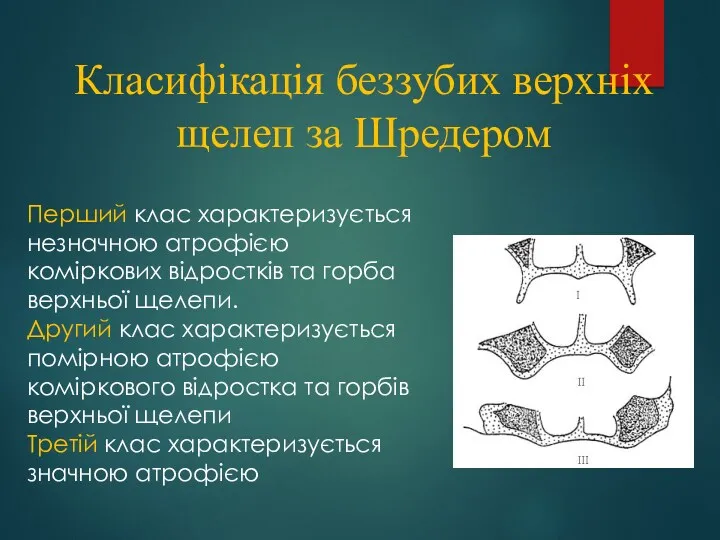 Класифікація беззубих верхніх щелеп за Шредером Перший клас характеризується незначною