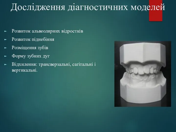 Дослідження діагностичних моделей Розвиток альвеолярних відростків Розвиток піднебіння Розміщення зубів