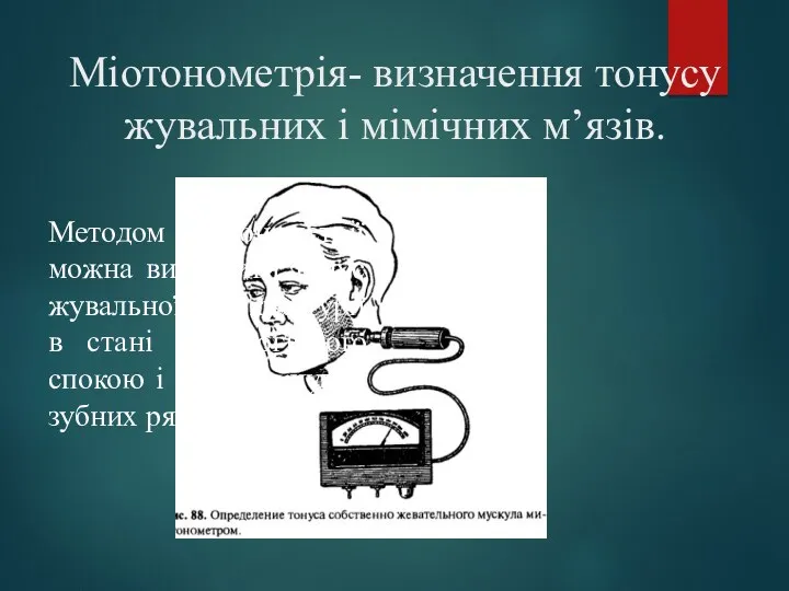 Міотонометрія- визначення тонусу жувальних і мімічних м’язів. Методом міотонометрії можна