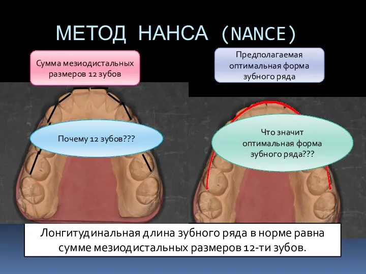 МЕТОД НАНСА (NANCE) Лонгитудинальная длина зубного ряда в норме равна