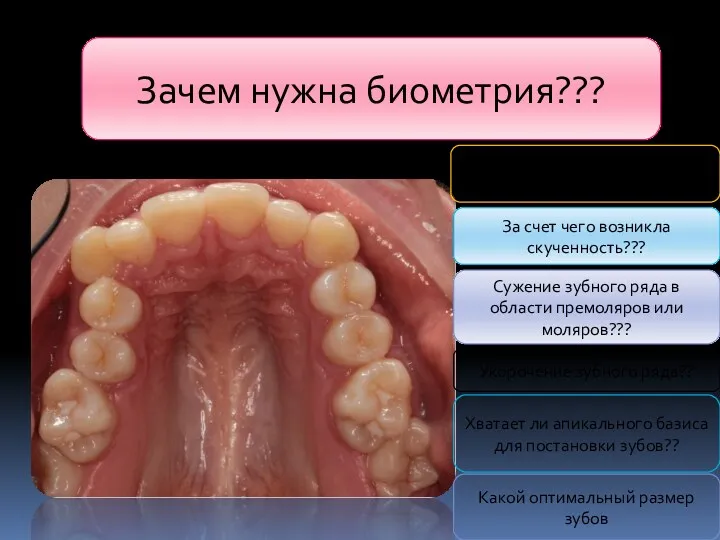 Зачем нужна биометрия??? Какова выраженность скученности??? За счет чего возникла