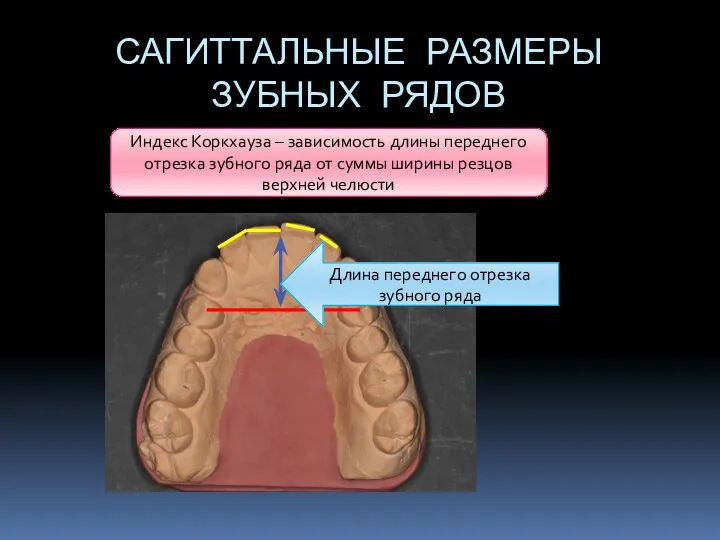 САГИТТАЛЬНЫЕ РАЗМЕРЫ ЗУБНЫХ РЯДОВ Индекс Коркхауза – зависимость длины переднего