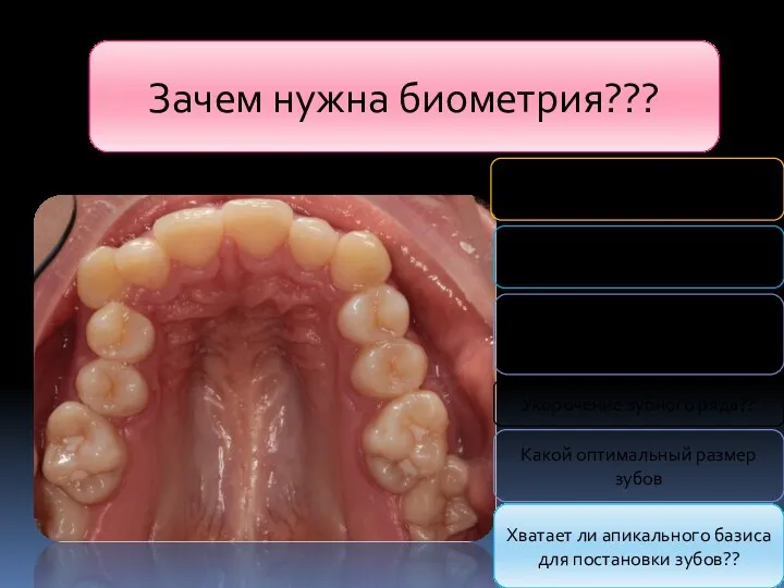 Зачем нужна биометрия??? Какова выраженность скученности??? За счет чего возникла