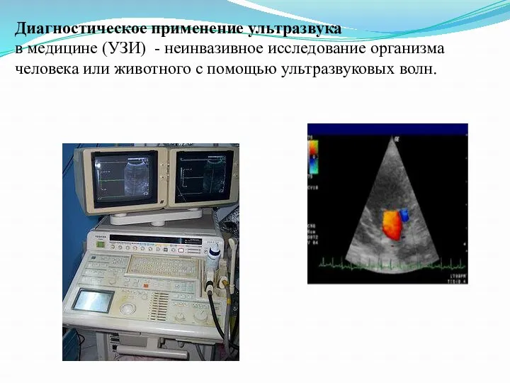 Диагностическое применение ультразвука в медицине (УЗИ) - неинвазивное исследование организма