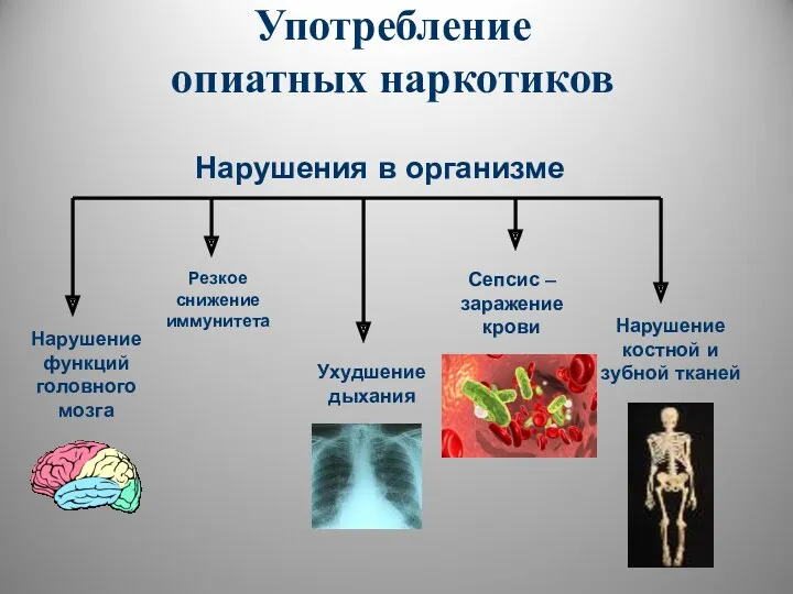 Употребление опиатных наркотиков Нарушение функций головного мозга Нарушение костной и