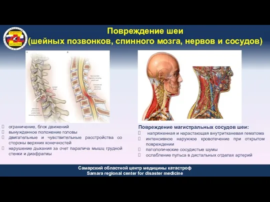Повреждение шеи (шейных позвонков, спинного мозга, нервов и сосудов) ограничение, блок движений вынужденное