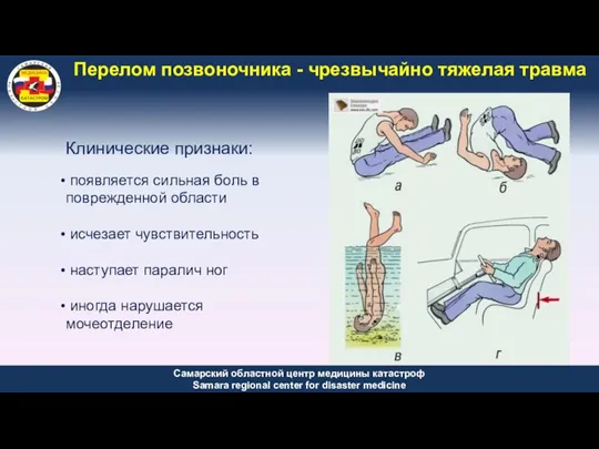 Перелом позвоночника - чрезвычайно тяжелая травма Клинические признаки: появляется сильная