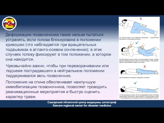 Деформацию позвоночника также нельзя пытаться устранять, если голова блокирована в