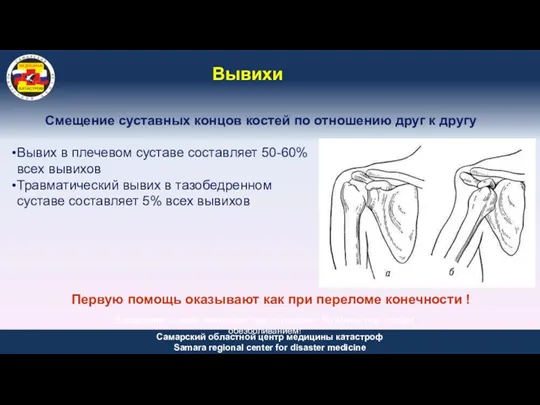 Вывихи Смещение суставных концов костей по отношению друг к другу