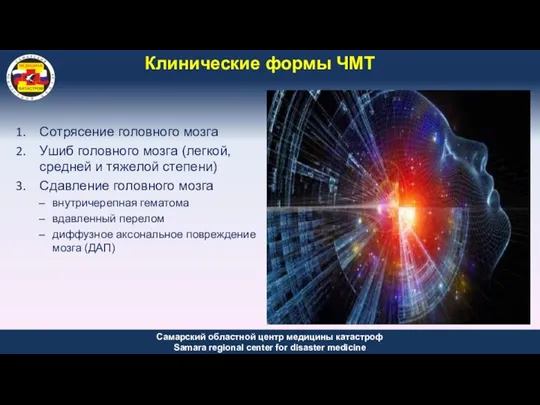 Клинические формы ЧМТ Сотрясение головного мозга Ушиб головного мозга (легкой,