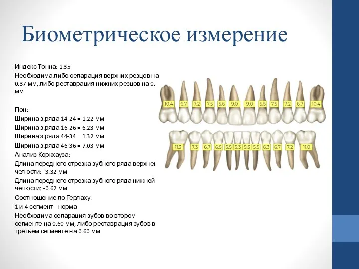 Биометрическое измерение Индекс Тонна: 1.35 Необходима либо сепарация верхних резцов