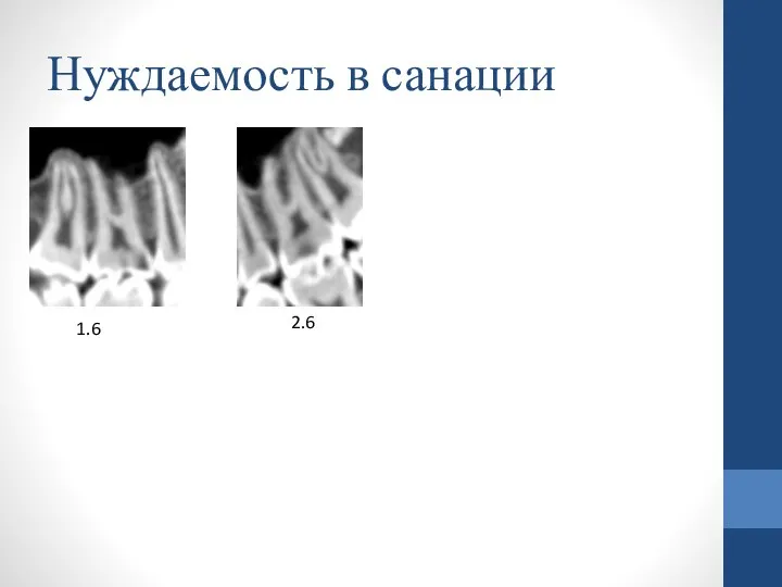 Нуждаемость в санации 1.6 2.6