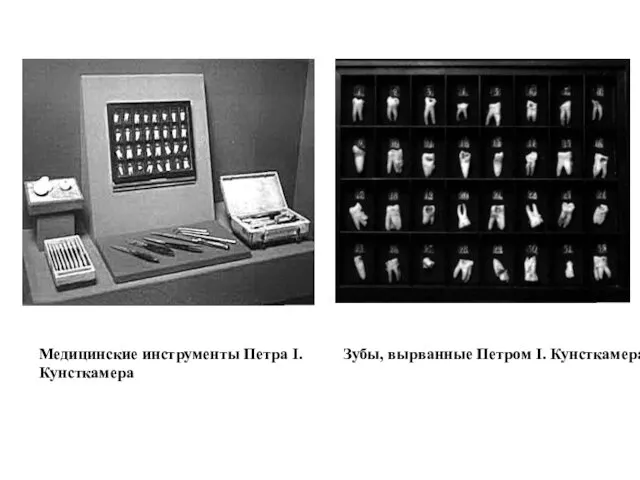 Медицинские инструменты Петра I. Кунсткамера Зубы, вырванные Петром I. Кунсткамера