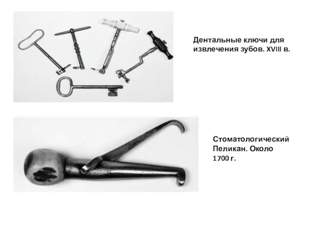 Дентальные ключи для извлечения зубов. XVIII в. Стоматологический Пеликан. Около 1700 г.