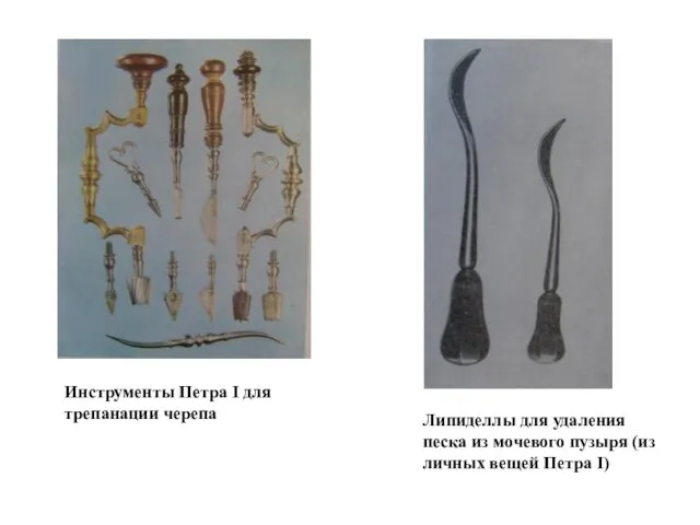 Инструменты Петра I для трепанации черепа Липиделлы для удаления песка
