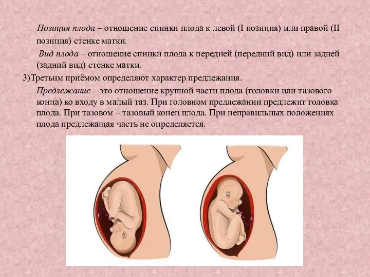 Позиция плода – отношение спинки плода к левой (I позиция)