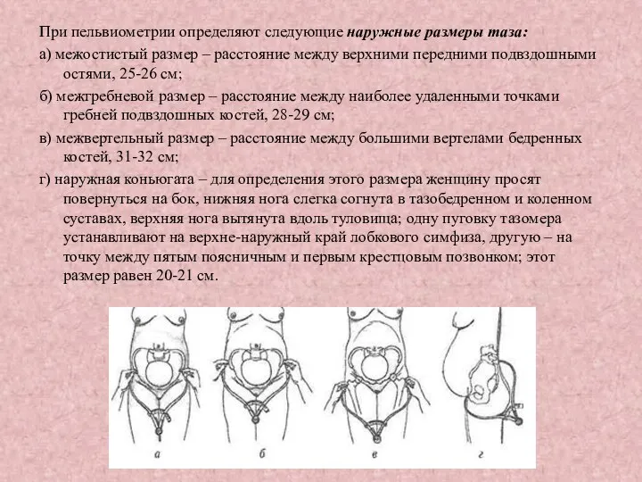 При пельвиометрии определяют следующие наружные размеры таза: а) межостистый размер