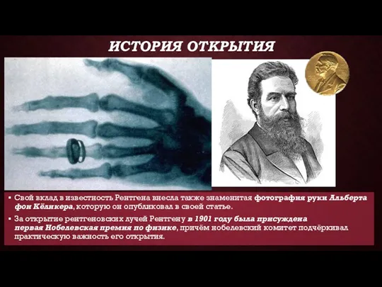 ИСТОРИЯ ОТКРЫТИЯ Свой вклад в известность Рентгена внесла также знаменитая