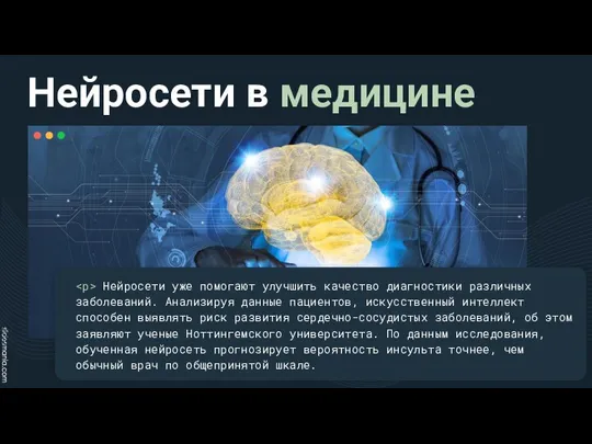 Нейросети в медицине Нейросети уже помогают улучшить качество диагностики различных