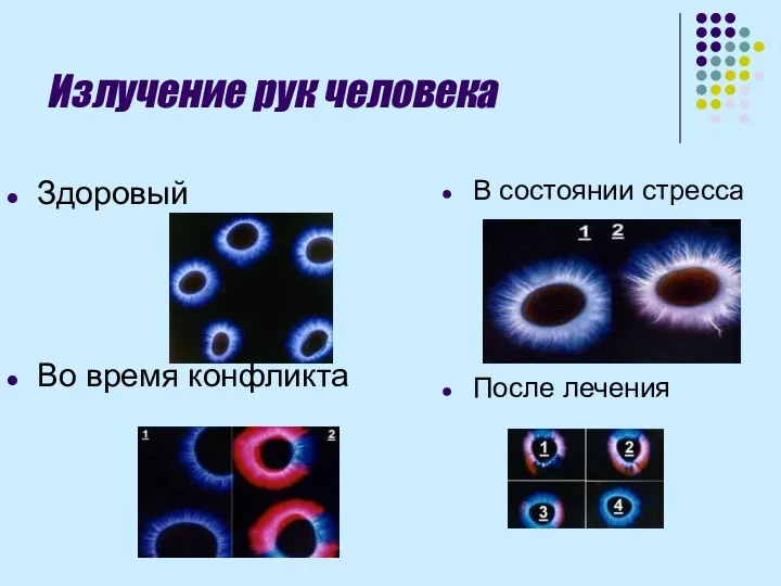 Излучение рук человека Здоровый Во время конфликта В состоянии стресса После лечения