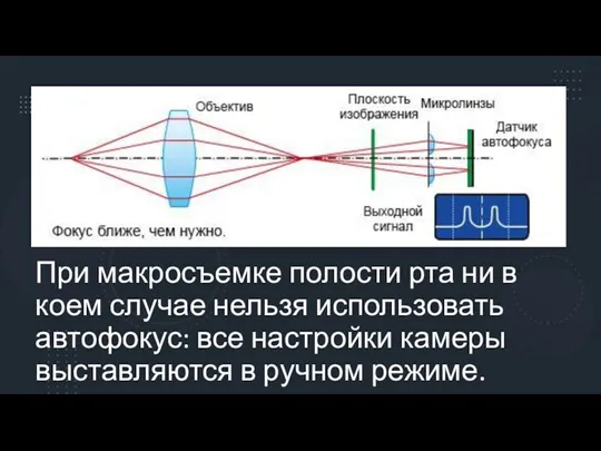 При макросъемке полости рта ни в коем случае нельзя использовать