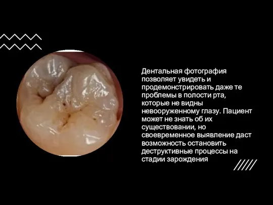 Дентальная фотография позволяет увидеть и продемонстрировать даже те проблемы в