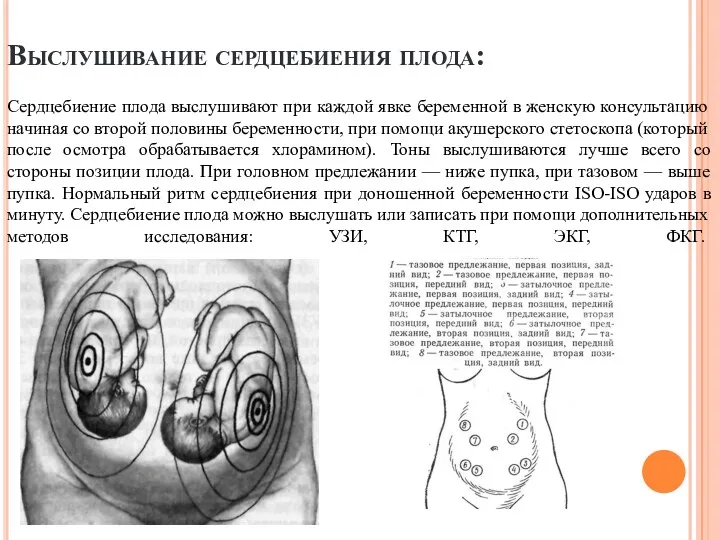 Выслушивание сердцебиения плода: Сердцебиение плода выслушивают при каждой явке беременной